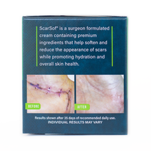 Load image into Gallery viewer, ScarSof 2 oz picture panel. Picture of hand surgery before and after. Results shown after 35 days of recommended daily use. Individual results may vary. Scar Sof is a surgeon formulated cream containing premium ingredients that help soften and reduce the appearance of scars while promoting hydration and overall skin health.