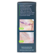 Load image into Gallery viewer, ScarSof 4 oz box side panel. Picture of a before and after hand. Results shown after 35 days of recommended daily use. Individual results may vary. ScarSof is a surgeon formulated cream containing premium ingredients that help soften and reduce the appearance of scars while promoting hydration and overall skin health.